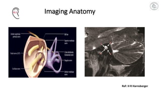 Imaging in Cochlear Implant Surgery: A Surgical Roadmap from CT–MRI to ...