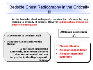 cc
At the bedside, chest radiography remains the reference for lung
imaging in critically ill patients. However, radiographical images are
often of limited quality
• Movements of the chest wall
• Film cassette posterior to the
thorax
• X-ray beam originating
anteriorly, at a shorter distance
than recommended and not
tangential to the diaphragmatic
cupola .
Mistaken assessment
of :
cc
• Pleural effusion
• Alveolar consolidation
• Alveolar-interstitial
syndrome
Bedside Chest Radiography in the Critically
ill
 