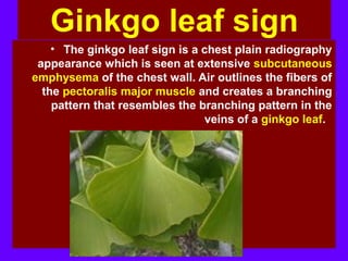 Ginkgo leaf sign
• The ginkgo leaf sign is a chest plain radiography
appearance which is seen at extensive subcutaneous
emphysema of the chest wall. Air outlines the fibers of
the pectoralis major muscle and creates a branching
pattern that resembles the branching pattern in the
veins of a ginkgo leaf.
 