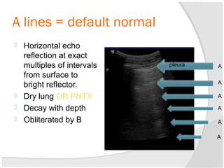 A lines = default normal
 Horizontal echo
reflection at exact
multiples of intervals
from surface to
bright reflector.
 Dry lung OR PNTX
 Decay with depth
 Obliterated by B
pleura A
A
A
A
A
A
 
