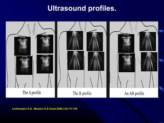 Ultrasound profiles.
Lichtenstein D A , Mezière G A Chest 2008;134:117-125
 