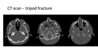 Imaging in Dentistry opg cbct cone beam ct | PPTX