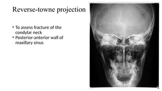 Imaging in Dentistry opg cbct cone beam ct | PPTX