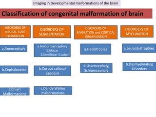Imaging in developmental malformations of the brain | PPTX