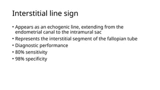 Comprehensive Imaging and Diagnostic Approach to Ectopic Pregnancy | PPTX