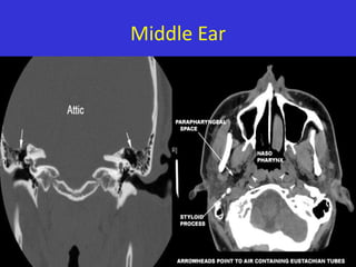 Middle Ear

 