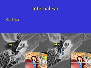 Internal Ear
Cochlea

 