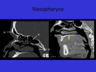 Nasopharynx

 
