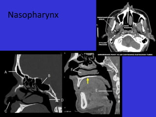 Nasopharynx

 