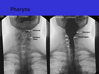 Pharynx

 