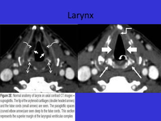 Larynx

 