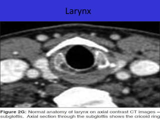 Larynx

 