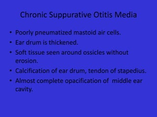 Chronic Suppurative Otitis Media
• Poorly pneumatized mastoid air cells.
• Ear drum is thickened.
• Soft tissue seen around ossicles without
erosion.
• Calcification of ear drum, tendon of stapedius.
• Almost complete opacification of middle ear
cavity.

 