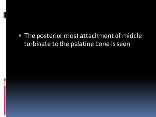  The posterior most attachment of middle
turbinate to the palatine bone is seen
 