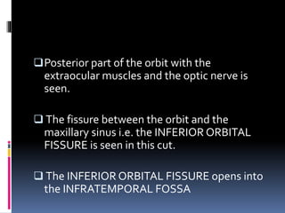 Posterior part of the orbit with the
extraocular muscles and the optic nerve is
seen.
 The fissure between the orbit and the
maxillary sinus i.e. the INFERIOR ORBITAL
FISSURE is seen in this cut.
 The INFERIOR ORBITAL FISSURE opens into
the INFRATEMPORAL FOSSA
 