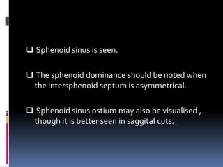  Sphenoid sinus is seen.
 The sphenoid dominance should be noted when
the intersphenoid septum is asymmetrical.
 Sphenoid sinus ostium may also be visualised ,
though it is better seen in saggital cuts.
 
