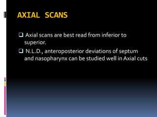 AXIAL SCANS
 Axial scans are best read from inferior to
superior.
 N.L.D., anteroposterior deviations of septum
and nasopharynx can be studied well in Axial cuts
 