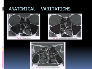ANATOMICAL VARITATIONS
 