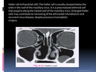 -drdhiru456@gmail.com
Haller cell (infraorbital cell):The Haller cell is usually situated below the
orbit in the roof of the maxillary sinus. It is a pneumatized ethmoid cell
that projects along the medial roof of the maxillary sinus. Enlarged Haller
cells may contribute to narrowing of the ethmoidal infundibulum and
recurrent sinus disease, despite previous (incomplete)
surgery.
 