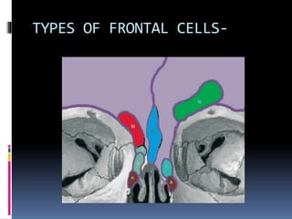 TYPES OF FRONTAL CELLS-
 