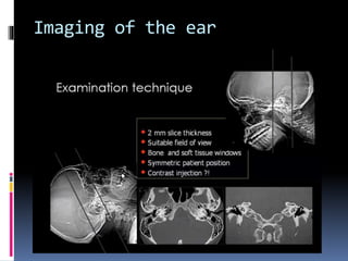 Imaging of the ear
 