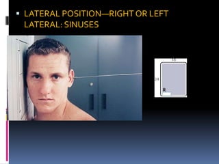  LATERAL POSITION—RIGHT OR LEFT
LATERAL: SINUSES
 