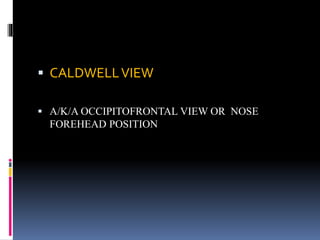  CALDWELLVIEW
 A/K/A OCCIPITOFRONTAL VIEW OR NOSE
FOREHEAD POSITION
 