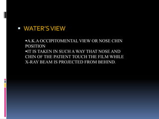  WATER’SVIEW
A.K.A OCCIPITOMENTAL VIEW OR NOSE CHIN
POSITION
IT IS TAKEN IN SUCH A WAY THAT NOSE AND
CHIN OF THE PATIENT TOUCH THE FILM WHILE
X-RAY BEAM IS PROJECTED FROM BEHIND.
 