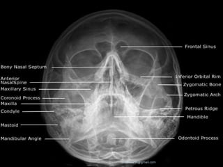 -drdhiru456@gmail.com
 