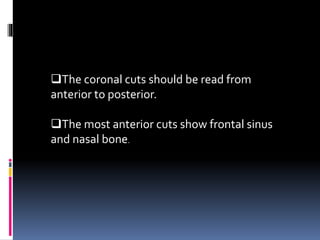The coronal cuts should be read from
anterior to posterior.
The most anterior cuts show frontal sinus
and nasal bone.
 