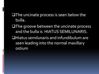 The uncinate process is seen below the
bulla.
The groove between the uncinate process
and the bulla is HIATUS SEMILUNARIS.
Hiatus semilunaris and infundibulum are
seen leading into the normal maxillary
ostium
 