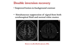 Imaging in epilepsy1 | PPTX