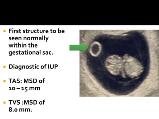  First structure to be
seen normally
within the
gestational sac.
 Diagnostic of IUP
 TAS: MSD of
10 – 15 mm
 TVS :MSD of
8.0 mm.
 