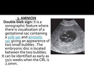3. AMNION
Double bleb sign: it is a
sonographic feature where
there is visualisation of a
gestational sac containing
a yolk sac and amniotic
sac giving an appearence of
two small bubbles .The
embryonic disc is located
between the two bubbles.
It can be identified as early as
51/2 weeks when the CRL is
2.0mm.
 