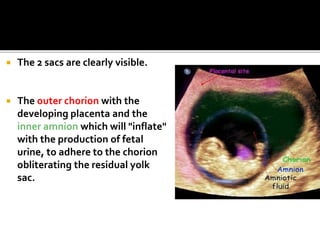  The 2 sacs are clearly visible.
 The outer chorion with the
developing placenta and the
inner amnion which will "inflate"
with the production of fetal
urine, to adhere to the chorion
obliterating the residual yolk
sac.
 