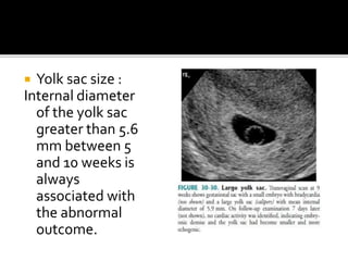  Yolk sac size :
Internal diameter
of the yolk sac
greater than 5.6
mm between 5
and 10 weeks is
always
associated with
the abnormal
outcome.
 