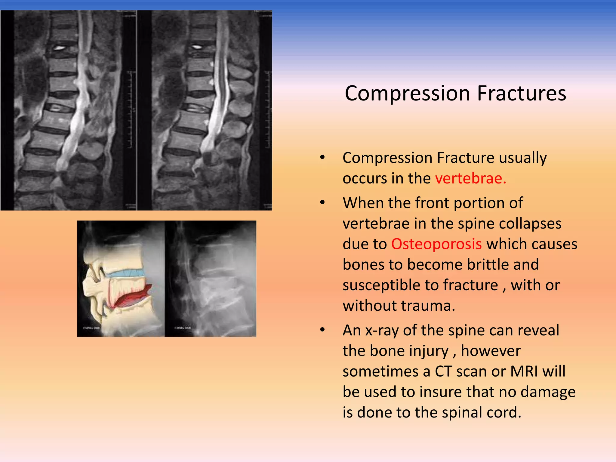 Compression Fractures
• Compression Fracture usually
occurs in the vertebrae.
• When the front portion of
vertebrae in the spine collapses
due to Osteoporosis which causes
bones to become brittle and
susceptible to fracture , with or
without trauma.
• An x-ray of the spine can reveal
the bone injury , however
sometimes a CT scan or MRI will
be used to insure that no damage
is done to the spinal cord.

 