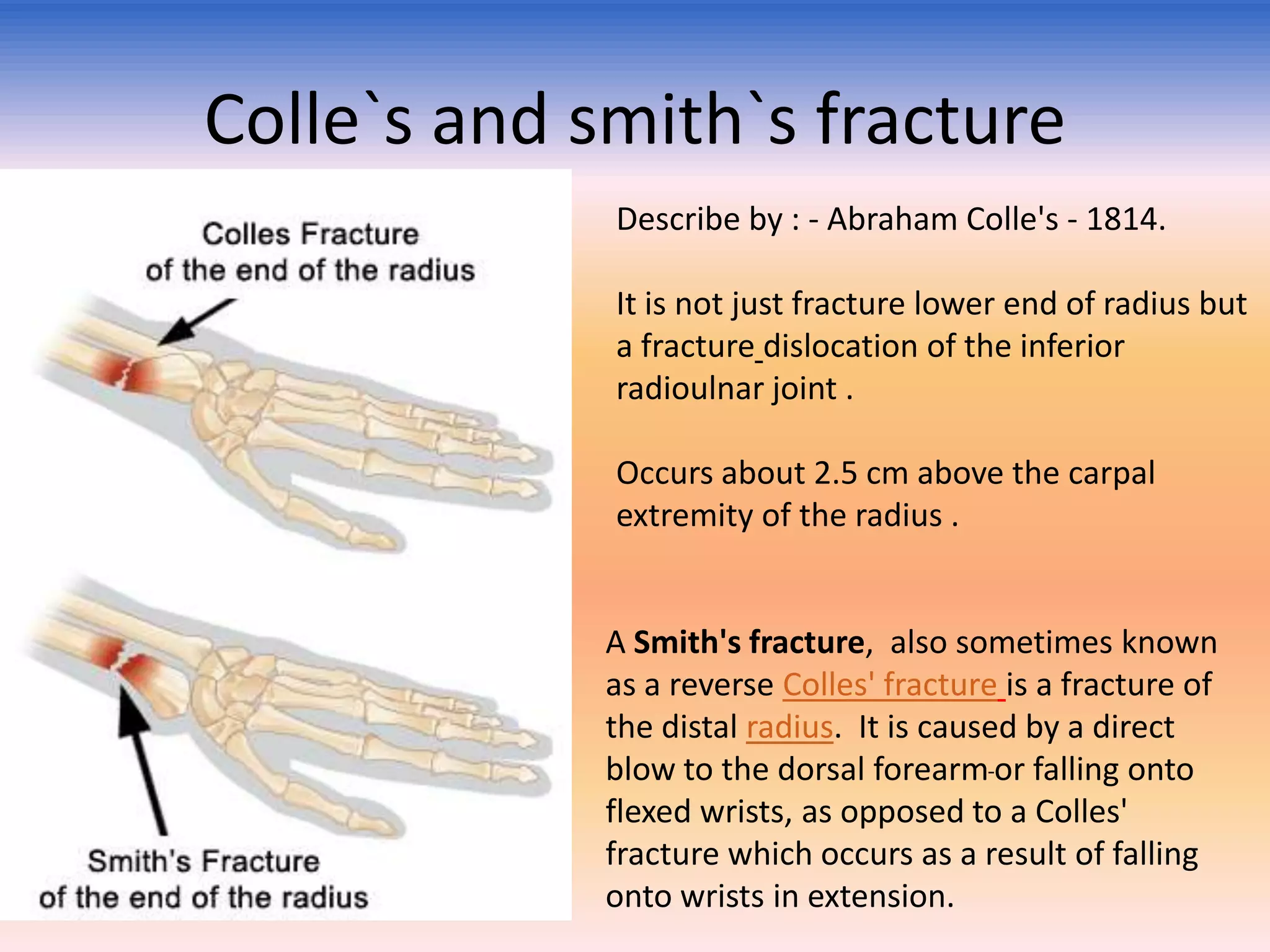 Colle`s and smith`s fracture
Describe by : - Abraham Colle's - 1814.

• Fig : -

It is not just fracture lower end of radius but
a fracture dislocation of the inferior
radioulnar joint .
Occurs about 2.5 cm above the carpal
extremity of the radius .

A Smith's fracture, also sometimes known
as a reverse Colles' fracture is a fracture of
the distal radius. It is caused by a direct
blow to the dorsal forearm or falling onto
flexed wrists, as opposed to a Colles'
fracture which occurs as a result of falling
onto wrists in extension.

 