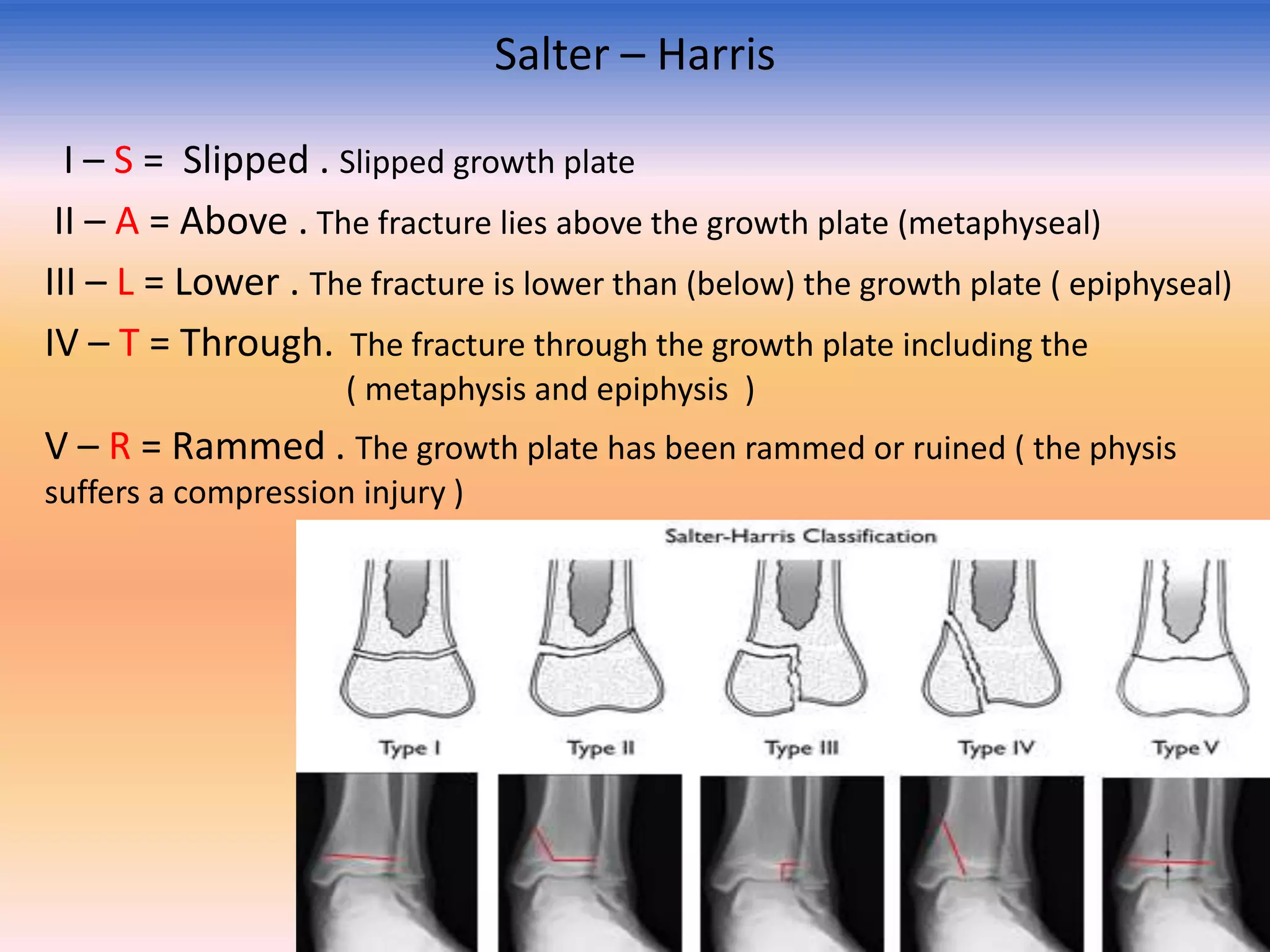 Salter – Harris
I – S = Slipped . Slipped growth plate
II – A = Above . The fracture lies above the growth plate (metaphyseal)
III – L = Lower . The fracture is lower than (below) the growth plate ( epiphyseal)
IV – T = Through. The fracture through the growth plate including the
( metaphysis and epiphysis )

V – R = Rammed . The growth plate has been rammed or ruined ( the physis
suffers a compression injury )

 