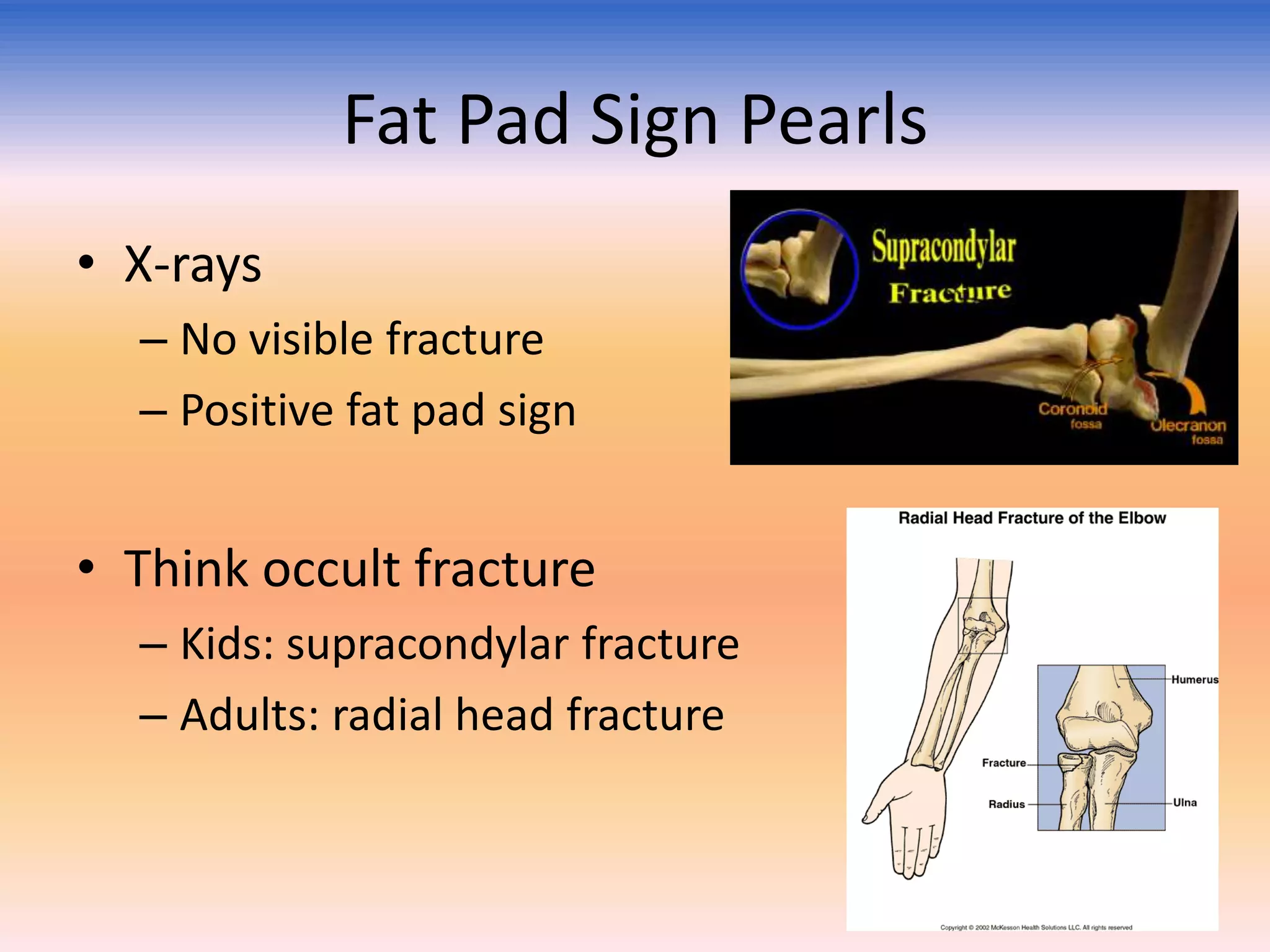 Fat Pad Sign Pearls
• X-rays
– No visible fracture
– Positive fat pad sign

• Think occult fracture
– Kids: supracondylar fracture
– Adults: radial head fracture

 