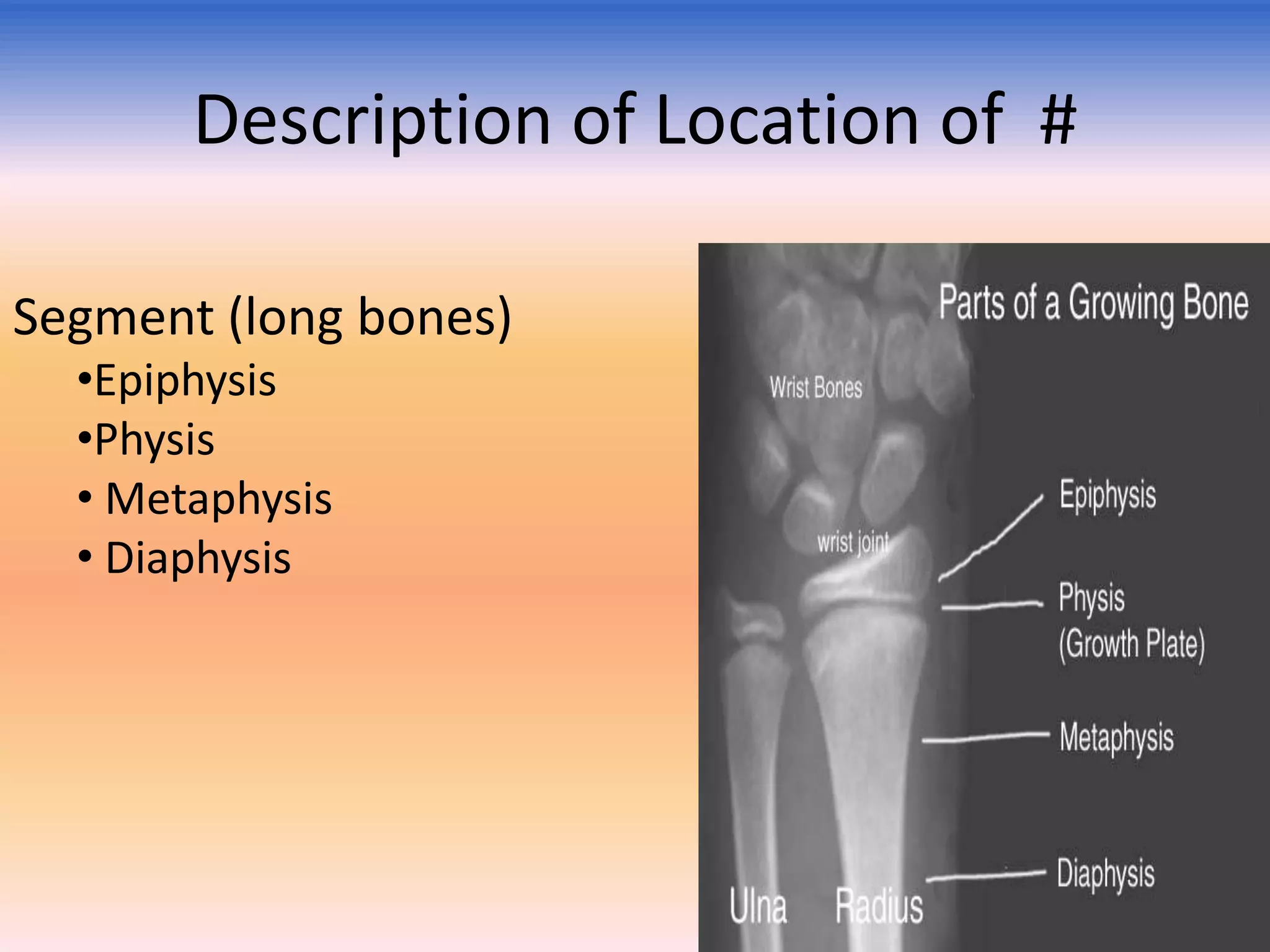 Description of Location of #
Segment (long bones)
•Epiphysis
•Physis
• Metaphysis
• Diaphysis

 