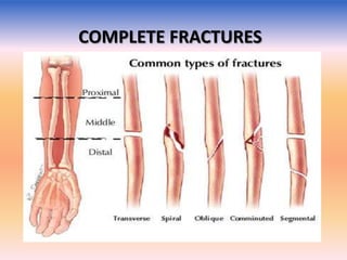 Complete Vs Incomplete Fracture