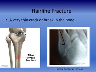 Imaging in Fractures and Dislocations-- An Introduction Dr. Muhammad …