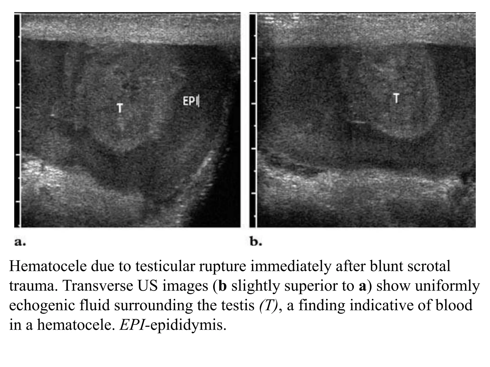 Imaging in genitourinary trauma | PPT Imaging in genitourinary trauma