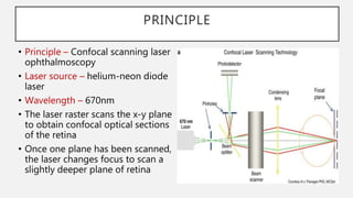 Imaging in Glaucoma | PPTX