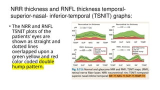 Nrr Graph Abstract imaging in glaucomaaaaaaaa dr paras.pptx