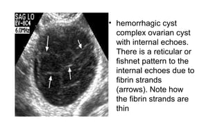 Imaging in gynaecology | PPTX