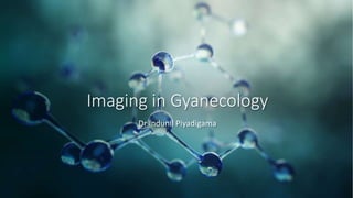 Imaging in Gyanecology
Dr Indunil Piyadigama
 