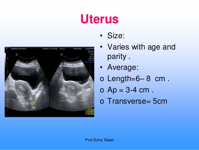 Normal Uterus Measurements Normal Uterus Measurements