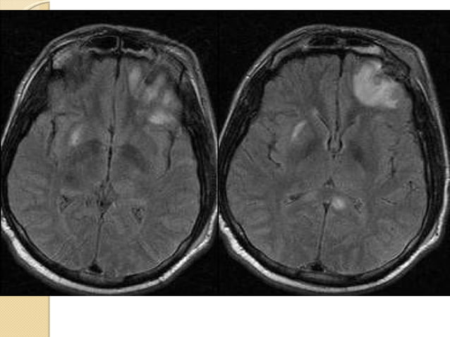 Imaging in head trauma | PPT